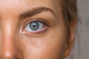 Tear Trough Filler Treatment